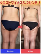 カルミア 心斎橋店/40代お客様／ゼロコース