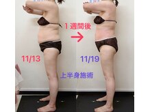 スマイルデイズ(Smiledays)/一週間でも結果を出します！