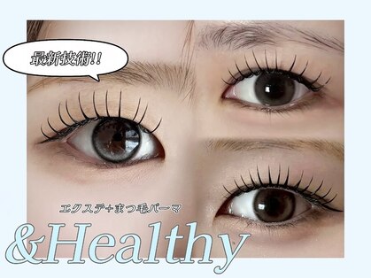 アリー 福井市西方(ALLY)の写真