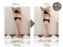 ビューティーリバース 戸塚店/★劇的ビフォーアフター★