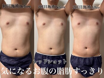 アンドエス 六本木(and S.)/話題のレッドショットのパワー！
