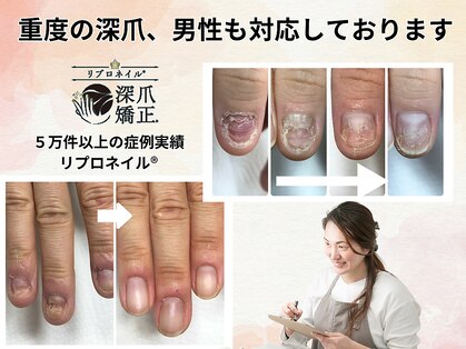 ブルームーンネイルズ(BLOOMOON.nails)の写真