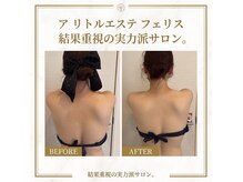 ア リトルエステ フェリス