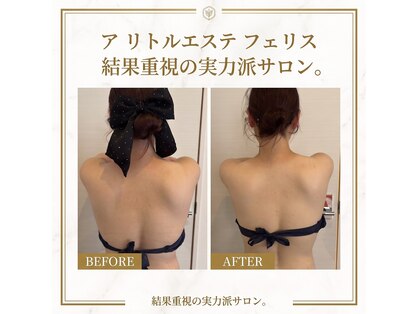 ア リトルエステ フェリスの写真