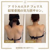 ア リトルエステ フェリス