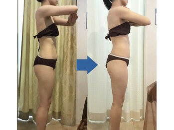 ピュアトゥルー 岐阜西店(PureTrue)/余分なお肉に高周波！ラジオ派！