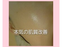 エタニティ(Eternity)/私のすっぴんの状態です(^^)