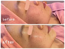 ヒメミ(Himemi)/艶肌Ｗａｘ