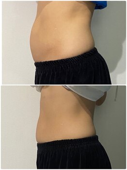 OBS/お腹集中ダイエット