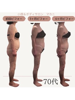 マカニ(Makani)/姿勢改善