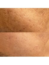 クレアス 勝どき(CREAS)/男性肌荒れ改善もお任せください