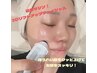 【小顔/たるみケア】ラジオ波リフトアップ+ヒアルロン酸導入（AI肌診断付き）