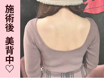 クイーンズチャーム(Queen's Charm)/パワーツリー★美背中