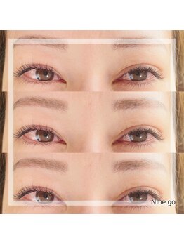 ナイン ゴー(Nine go)/フラットラッシュ