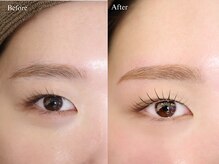 エンカシェット 代官山(En’e cachette)/【矯正美眉】魅惑の黄金比