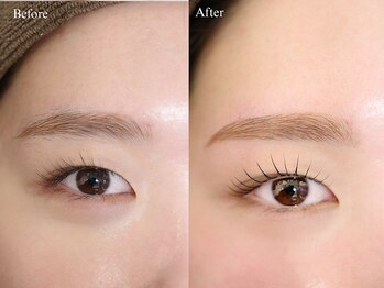 エンカシェット 代官山(En’e cachette)/【矯正美眉】魅惑の黄金比