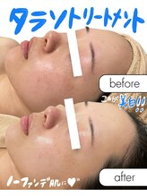 ラカ 長野駅前本店(LaKa)/ノーファンデを目指せる