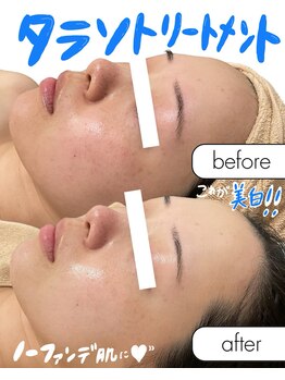 ラカ 長野駅前本店(LaKa)/ノーファンデを目指せる