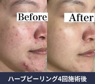 エルア 尼崎(Elua)