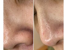 サイ(Sai)/before⇒after