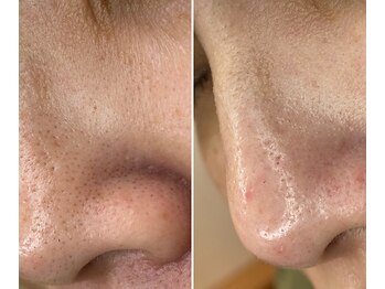 サイ(Sai)/before⇒after