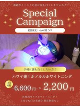 ホノルルホワイトニング 京橋店/素敵なイベント前に歯を白く♪