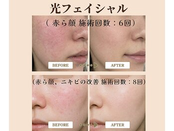 アフロディーテ(Aphrodite)/