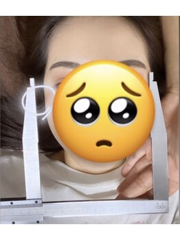 モトヨシ(MOTOYOSHI)/頬幅の変化