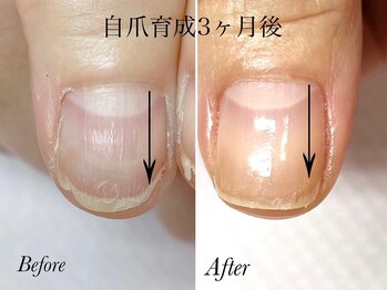トゥインクリーネイルサロン(Twinkly Nail Salon)/【地爪育成】1回お試し