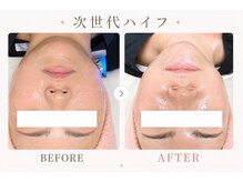 パールプラス 本庄早稲田店(Pearl plus)/小顔リフトアップも叶う