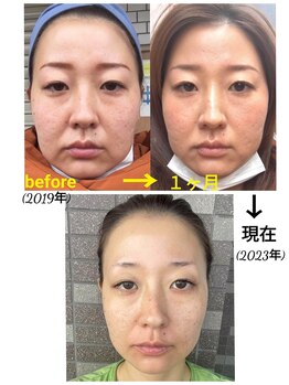 ばんでふぉれの写真/店内とインスタなどで、お客さまの結果お写真が見られます