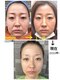 ばんでふぉれの写真/店内とインスタなどで、お客さまの結果お写真が見られます