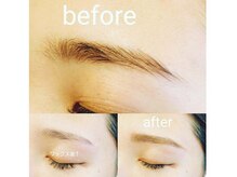 ビビ スイート(美be Suite)/顔脱毛でＮＧなまぶたにＷＡＸ