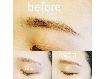 ビビ スイート(美be Suite)/顔脱毛でＮＧなまぶたにＷＡＸ