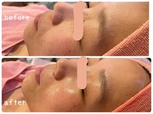 ヒメミ(Himemi)/艶肌Ｗａｘ