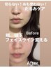【頬/顎下/フェイスライン/小顔革命神メニュー】たるみケア×小顔120分¥16500