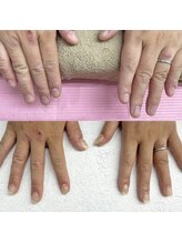 ハッカネイル(HAKKA NAIL)/