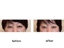 シエル(Ciel)/別人級の変化