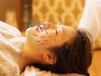 岩川治療院の写真/【エンビロン×美容鍼】☆相乗効果で、つるんとした透明感溢れる水光肌を実現。確かな技術で高い満足感を◎