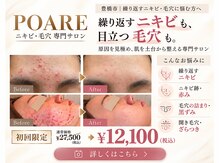 ポアレ(POARE)