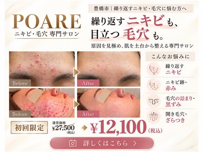ポアレ(POARE)の写真