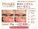 ポアレ(POARE)の写真