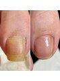 ランカ(RUNKA) 爪のケア。まるで別人のお爪に