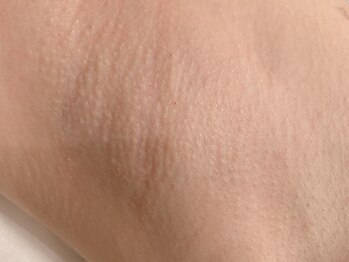 ルゥルゥ シュガーリング(Luu Luu sugaring)/シュガーリング脱毛/代々木上原