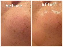 ヒメミ(Himemi)/艶肌Ｗａｘ