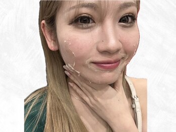 ビューティービューティー(beauty×beauty)の写真/長年の経験と実績で結果の出るハーブピーリングを厳選！お肌に合わせたハ-ブピ-リングでツルツル美肌に◎