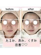 ブランルピナス(Blanc Lupinus)/