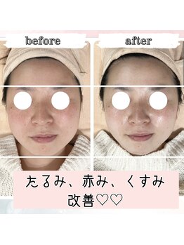 ブランルピナス(Blanc Lupinus)/