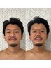 【メンズブライダル】かっこよくなりたい新郎へ告ぐ！徹底小顔メソッド