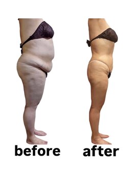 ウィズルーチェ 神栖店(with luce)/50代〇〇さんの変化　痩ボディへ